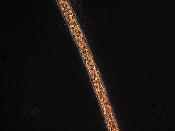 This Trichodesmium tenue strain is the salmon pink variety.