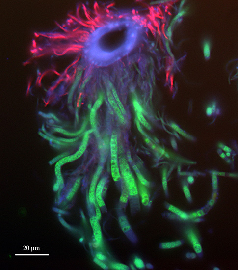 WHOI microbiologist Stefan Sievert and colleagues used FISH, or Fluorescence In Situ Hybridization, to localize and identify the microbes living in different parts of the gill chambers of shrimp living near hydrothermal vents.