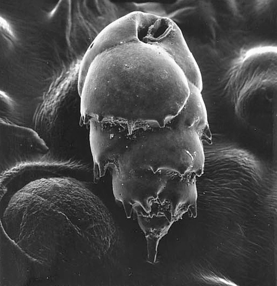 Bulimina sp.