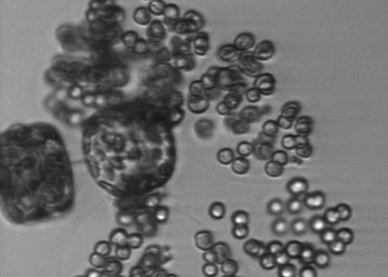 Phytoplankton bloom