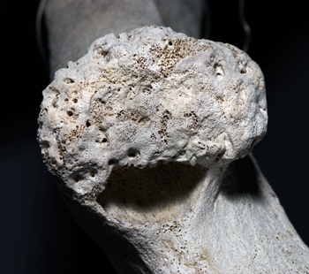 whale bone