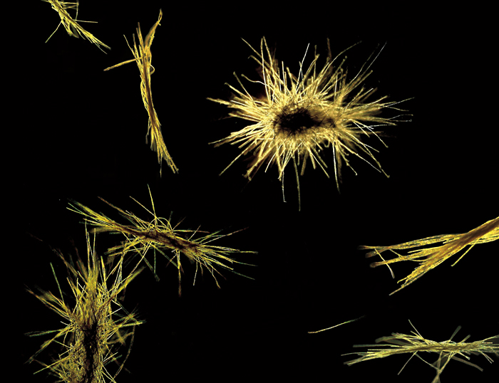 Trichodesmium colonies