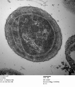 Synechococcus WH8102.