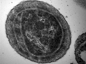 Marine Cyanobacterial Proteomics