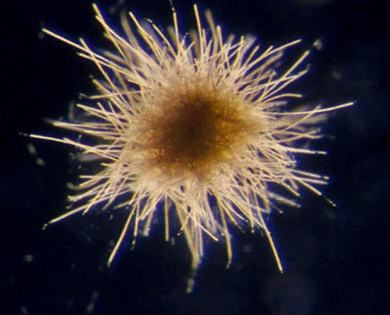 Using the VPR, scientists found surprising abundances of cyanobacterium, such as Trichodesmium thiebautii.