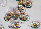 Woods Hole Center for Oceans & Human Health