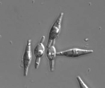  sl102diatom