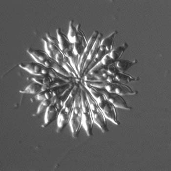 diatom