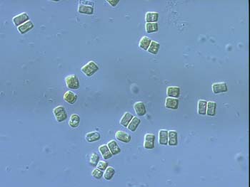 i76Diatom