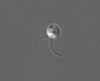 phaeocystis