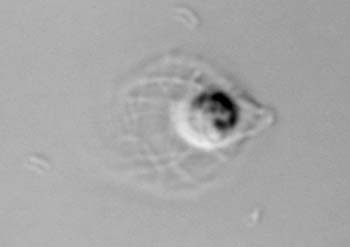 sl117choano