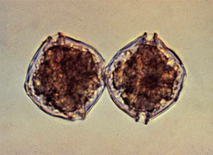 Cells of alexandrium.