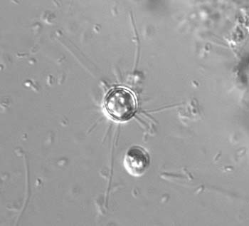 mc51chrysophyte
