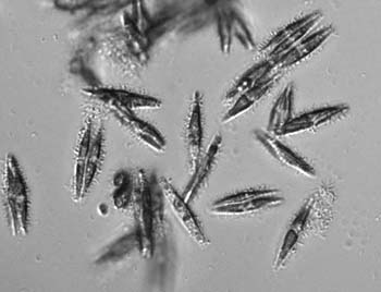 rs201diatom
