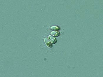 sl101diatom