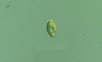 sl1492diatom