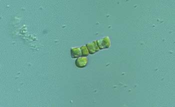 sl1494diatom
