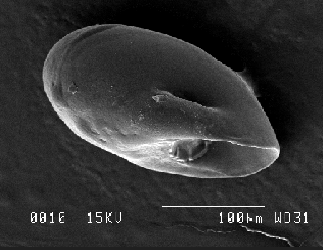 Eulepetopsis vitrea SSEM