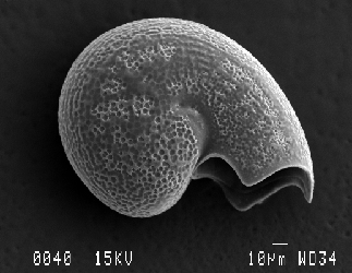 Gorgoleptis emarginatus SEM