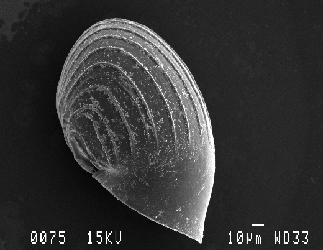 Peltospira sp. SEM