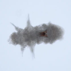Ophryotrocha sp.