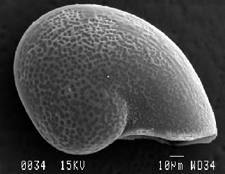 pointy apex SEM