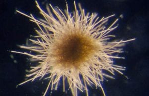 Ocean Microscope Reveals Surprising Abundance of Life