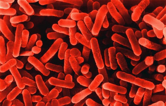 Legions of Legionella Bacteria