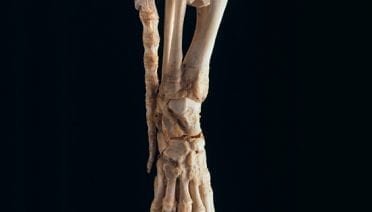 Bare Bones