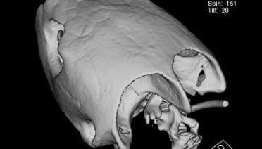 Shock-resistant skulls