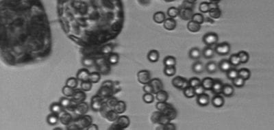 Beneath Arctic Ice, Life Blooms Spectacularly