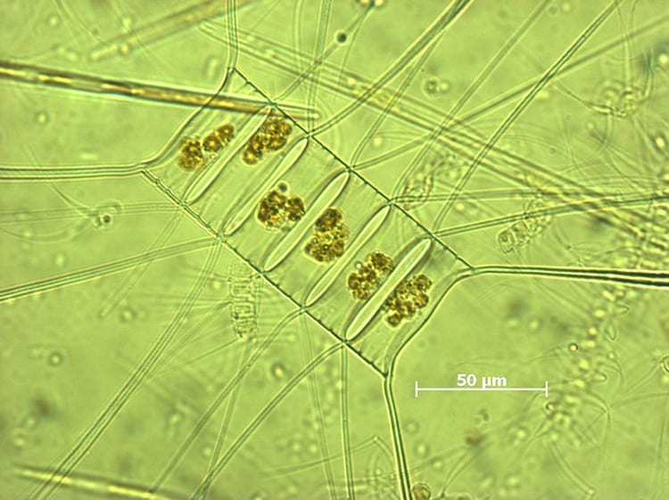 Chaetoceros_decipiens350_294853.jpg