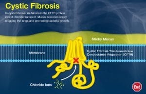 Cystic Fibrosis