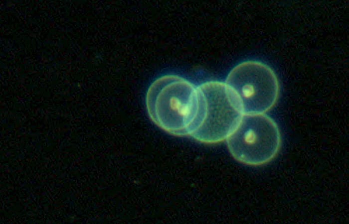 bj8_vpr5a_protozoa_orbs_roi.5426836400-copy.jpg