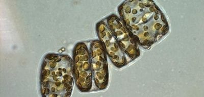 Short-circuiting the Biological Pump