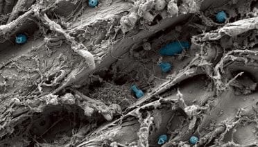 The Plastisphere