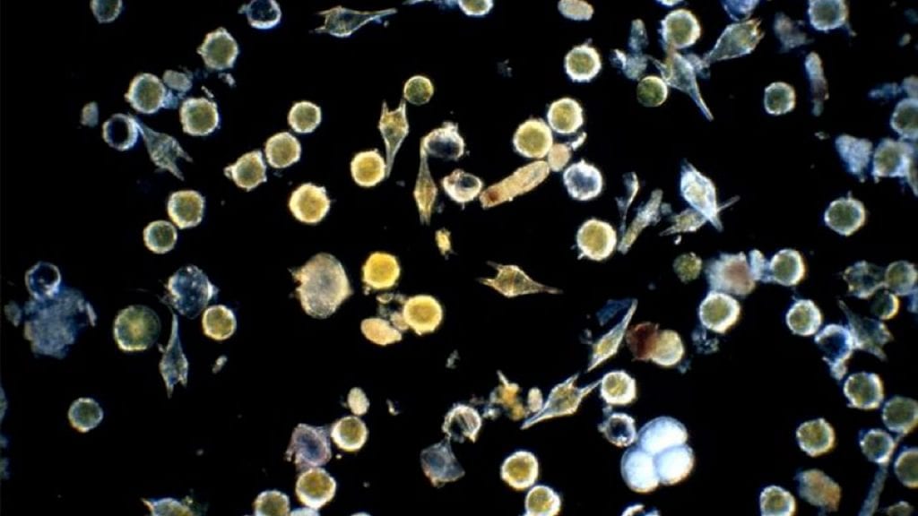 graphics-HABs-Microscopy-cells-Plankton_assemblage-withAlexandrium.jpg