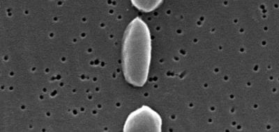 Vibrio parahaemolyticus