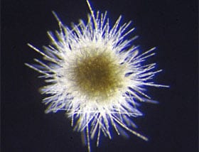 A puff colony of Trichodesmium thiebautii
