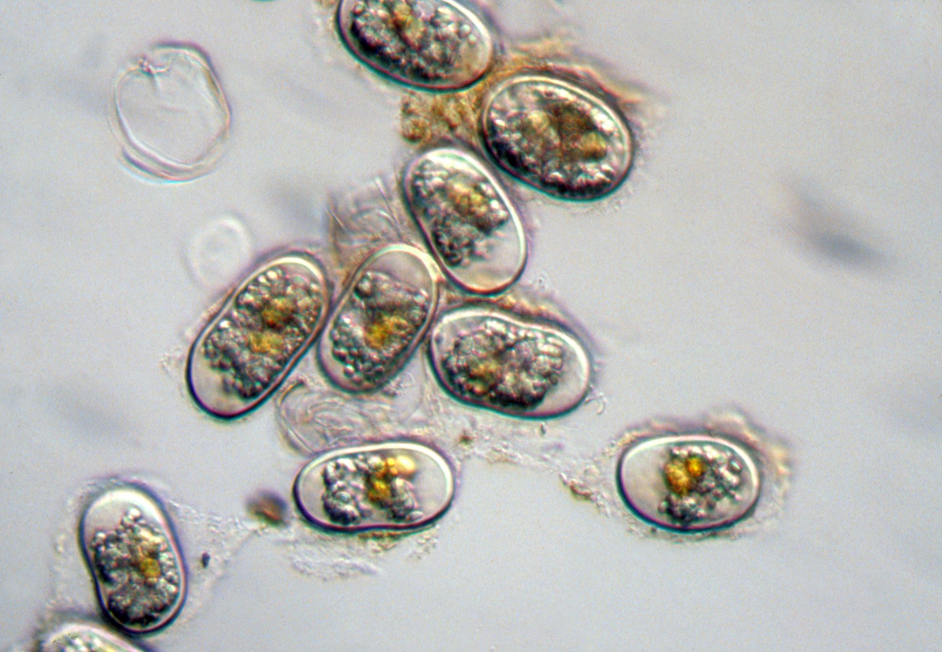 Alexandrium_tamarense-cysts - HAB cells under a microscope - image 157101 (1) Microscope Image