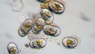 Cells Under Microscope
