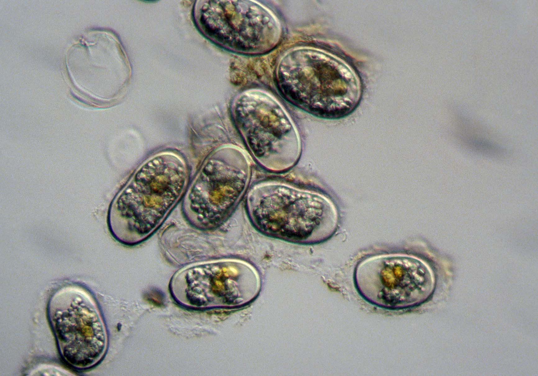 Microscopic view of A. tamarense cysts.