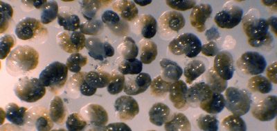 Light micrograph of the benthic foraminifer Nonionella stella, which thrives in anoxic sulfidic sediments far below the euphotic zone. Individuals are ~225 microns in diameter. (Image credit: J.M. Bernhard © Woods Hole Oceanographic Institution)