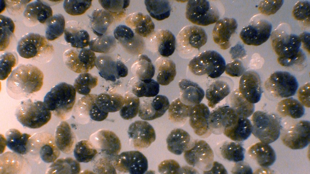 Light micrograph of the benthic foraminifer Nonionella stella, which thrives in anoxic sulfidic sediments far below the euphotic zone. Individuals are ~225 microns in diameter. (Image credit: J.M. Bernhard © Woods Hole Oceanographic Institution)