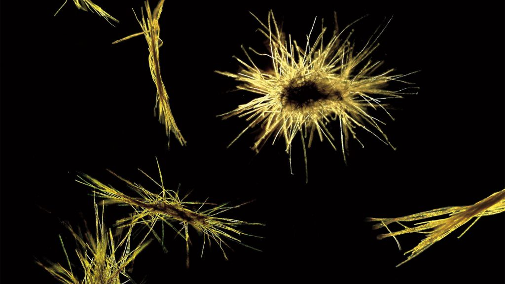 Species of the single-celled phytoplankton Trichodesmium form colonies with distinctive shapes. Individual colonies, shown here, are visible to the naked eye; where currents and winds gather many colonies together, the aggregation can be seen from orbiting satellites. (Photo by Abby Heithoff, MIT/WHOI Joint Program student)