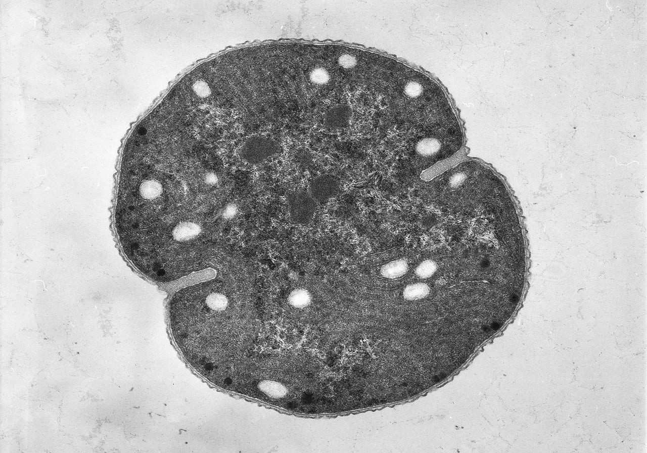 Electron microscopic image of the cynobacterium, Crocosphaera watsonni. Photo courtesy of John Waterbury and Freddy Valois @Woods Hole Oceanographic Institution