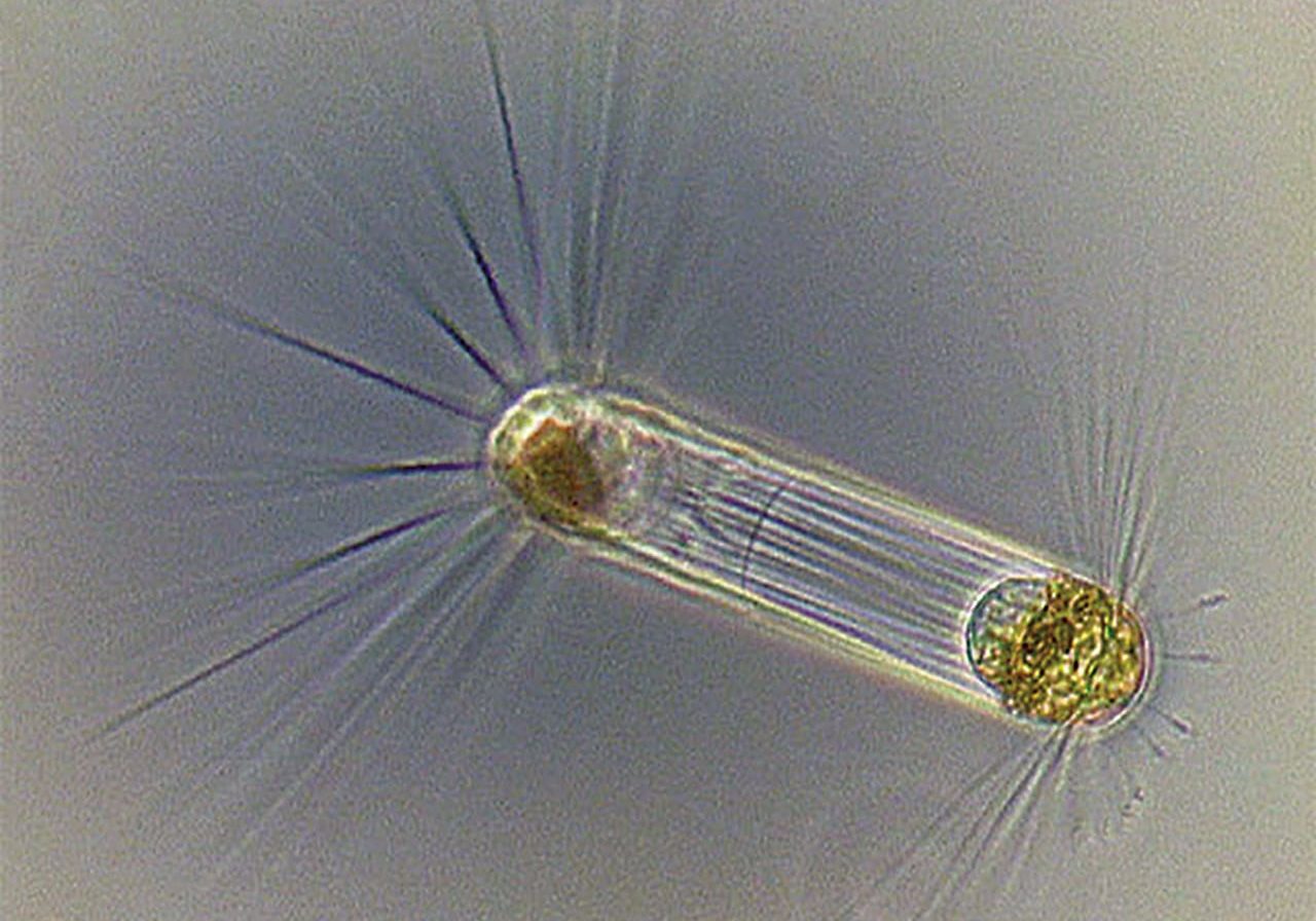 Diatoms, like this Corethron, use photosynthesis to live, grow, and multiply. Photo by Dawn Moran @Woods Hole Oceanographic Institution