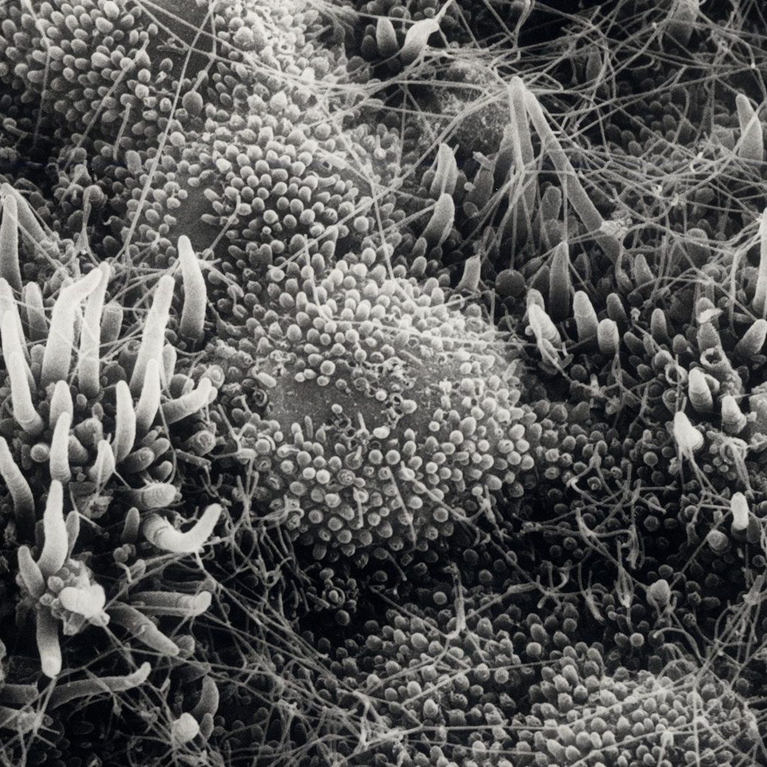 microbes