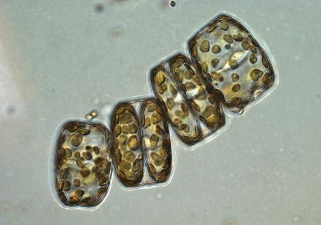 Marine phytoplankton like these Melosira sp. play critical roles that have impacts on the ocean food web and Earth's climate. (Photo by Dawn Moran, © Woods Hole Oceanographic Institution)